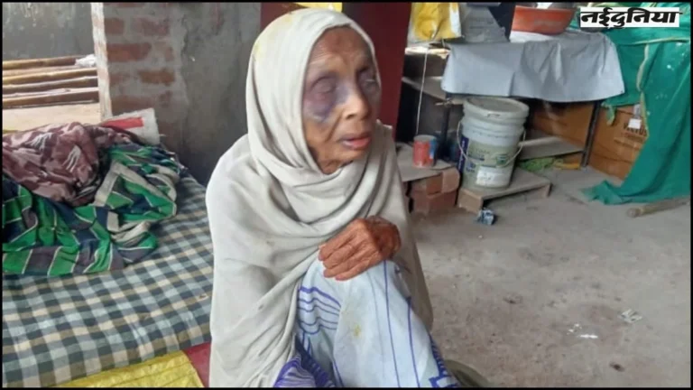भोपाल : कलयुगी पोता…दादी के बार-बार घर से भटक जाने से नाराज था पोता, मुंह पर मारे मुक्के, हुई मौत