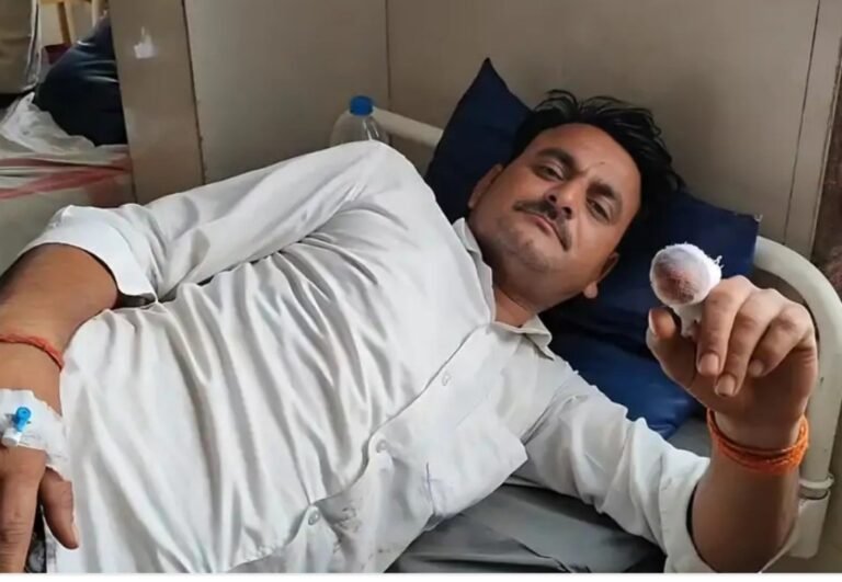 शिवपुरी : ये कैसा दुकानदार? उंगली ही चबा गया, खराब नमकीन वापस करने पहुंचा था शख्स